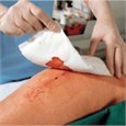 Wound Dressing Pads